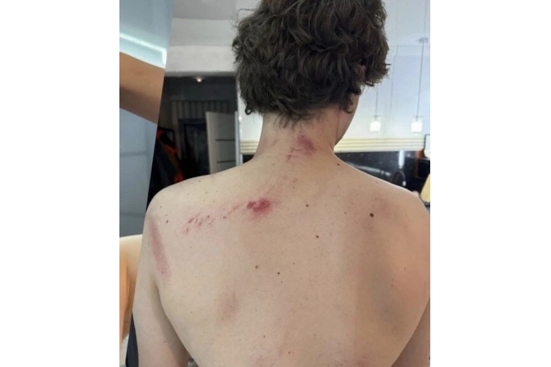 Полиция заинтересовалась избиением мужчины в многоэтажке Ставрополя Пресс-служба полиции Ставрополья