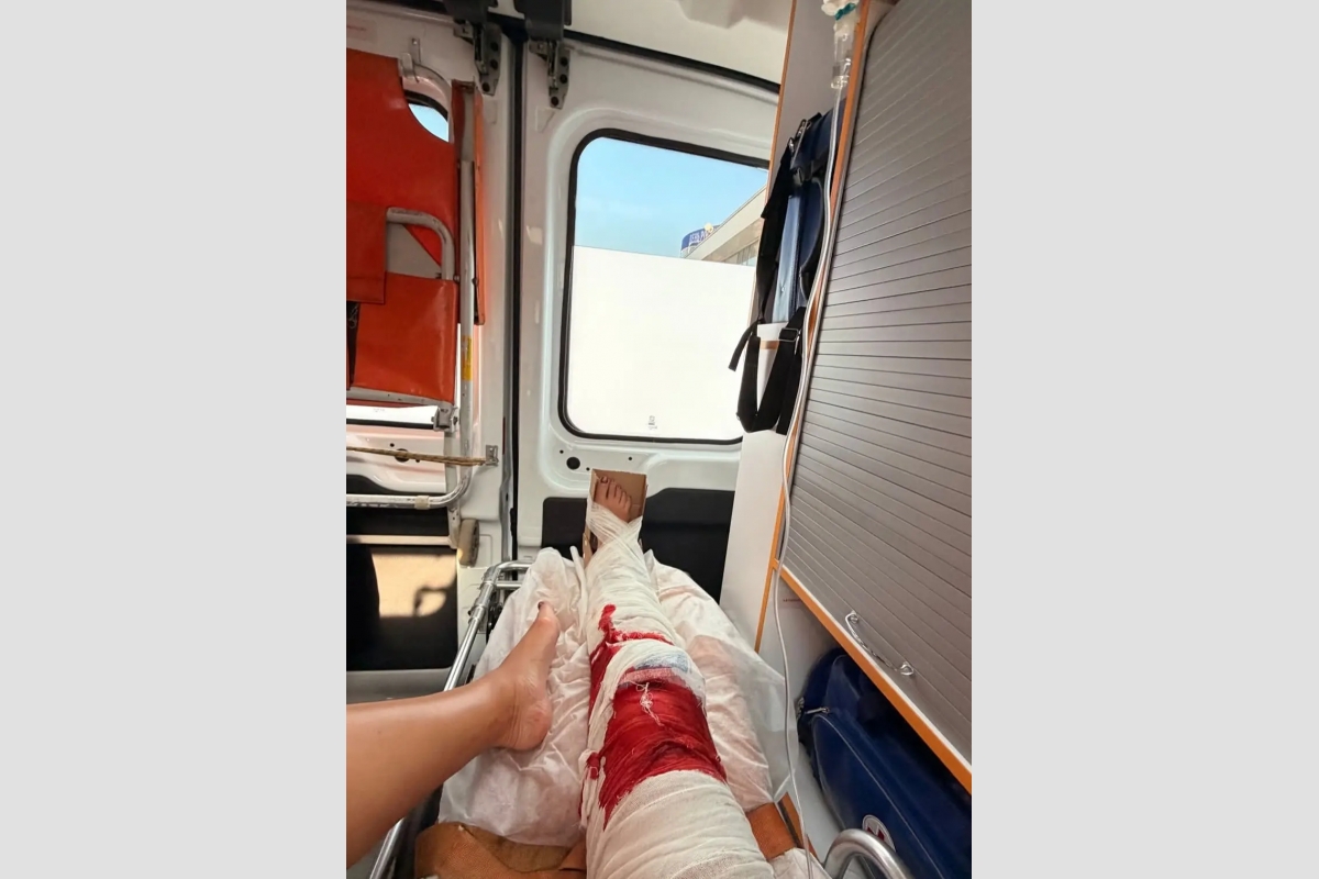 Ольга Бузова попала в больницу с травмой Соцсети Ольги Бузовой